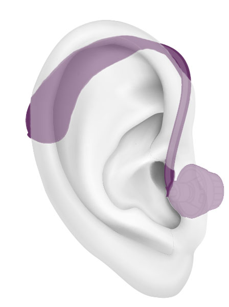 Een visueel van een luidspreker-in-het-oor hoortoestel